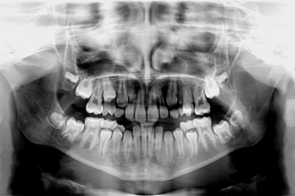 Ortopantomografía, telerradiografía y TAC: nuestros servicios de diagnóstico dental