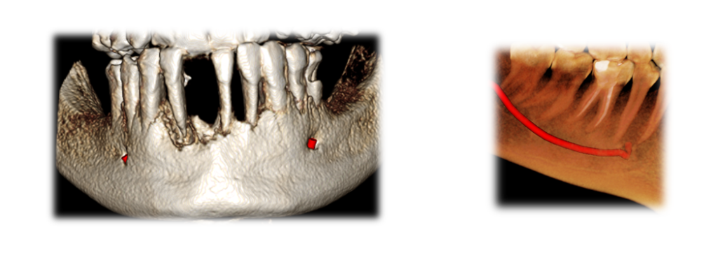 TAC dental